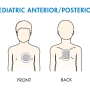 padplacement_pedi_anteriorposterior.jpg